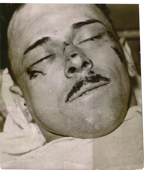 John Dillinger Facial