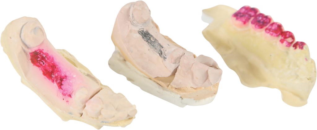 Elvis Presley‚s Teeth Mold from his Dentist (3)